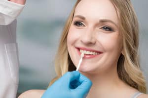 care for dental veneers