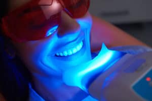 professional teeth whitening